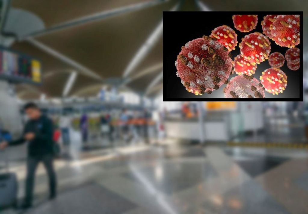 Confirman primer caso de sarampión vinculado a viajes internacionales